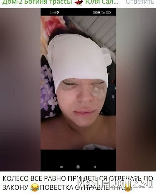 Бывшая жена Салибекова предстала перед подписчиками с отёками и в бинтах Бывшая жена Салибекова предстала перед подписчиками с отёками и в бинтах