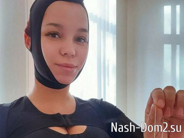 Бывшая жена Салибекова предстала перед подписчиками с отёками и в бинтах Бывшая жена Салибекова предстала перед подписчиками с отёками и в бинтах