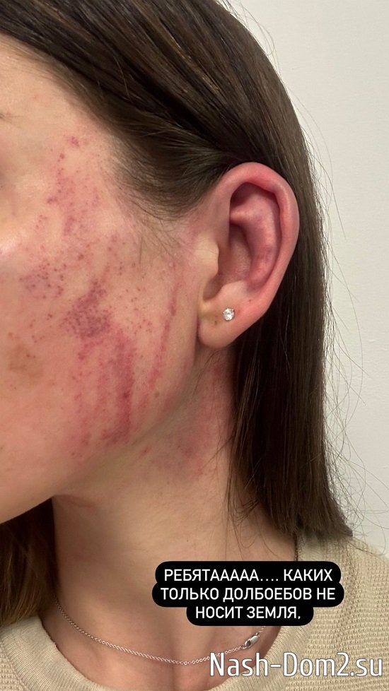 Алеся Семеренко: Он готов был убить меня! Алеся Семеренко: Он готов был убить меня!