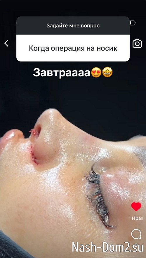 ���� ����������: ������ �� ������ ���� ����� �����