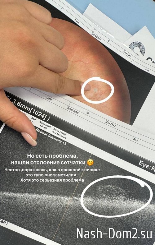 ���� �������: ������ ����������� ����