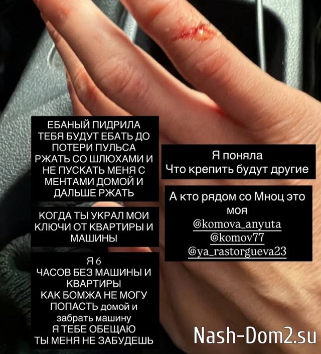 Анна Брянская стала жертвой абьюзера Анна Брянская стала жертвой абьюзера