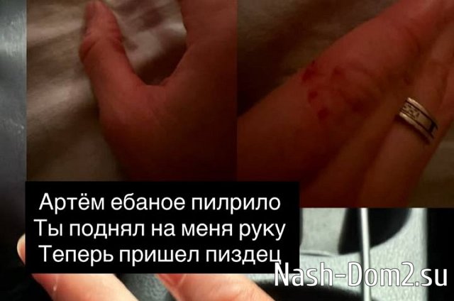 Анна Брянская стала жертвой абьюзера Анна Брянская стала жертвой абьюзера
