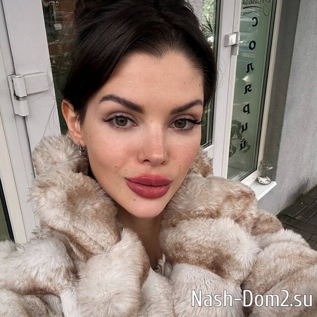 Анна Евстропова прозрела и больше не будет делать губы Анна Евстропова прозрела и больше не будет делать губы