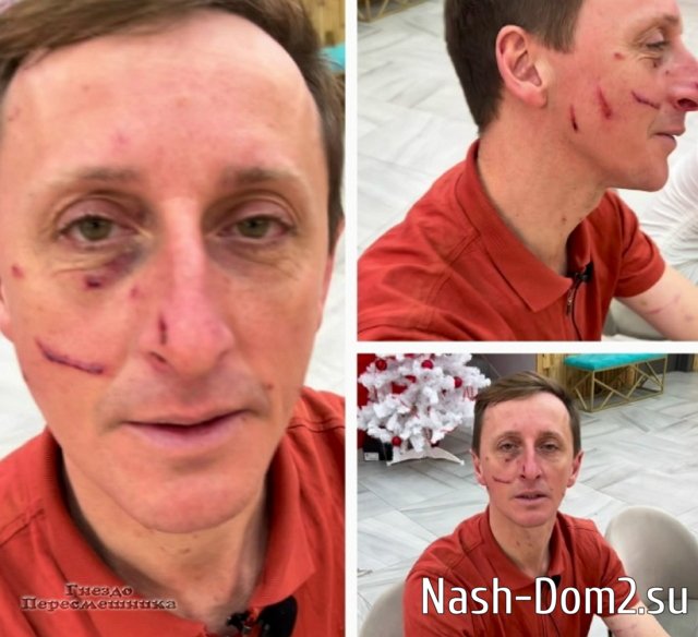 Дмитрий Лысковец: Альбатрос, давай-ка ноги в руки и на вокзал Дмитрий Лысковец: Альбатрос, давай-ка ноги в руки и на вокзал