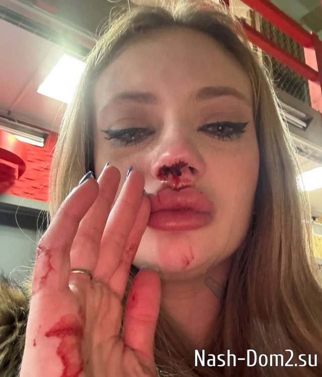 ������ �������: � ����� ������ ������ ����� ��� �������