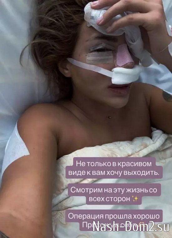 Виктория Дилье избавилась от «старого лица» Виктория Дилье избавилась от «старого лица»