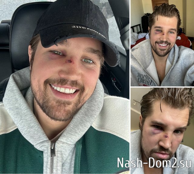 ����� ��������: � ������ �� �������