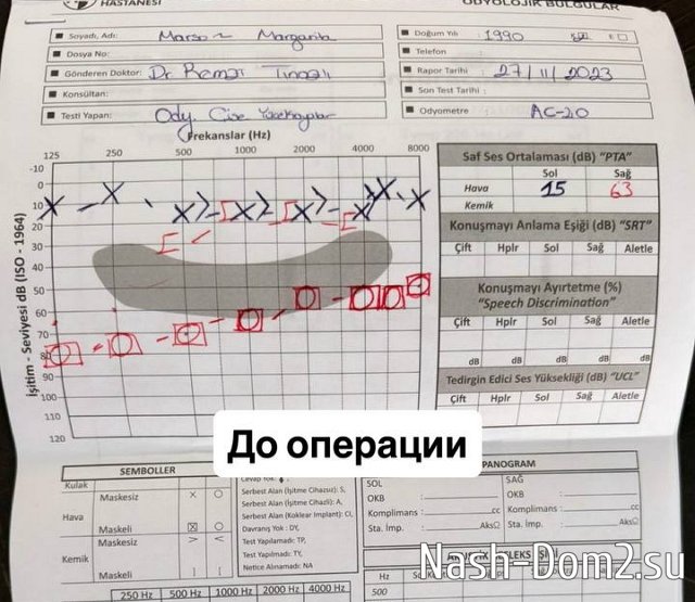 Рита Марсо: Вдруг начались какие-то щелчки в ухе Рита Марсо: Вдруг начались какие-то щелчки в ухе