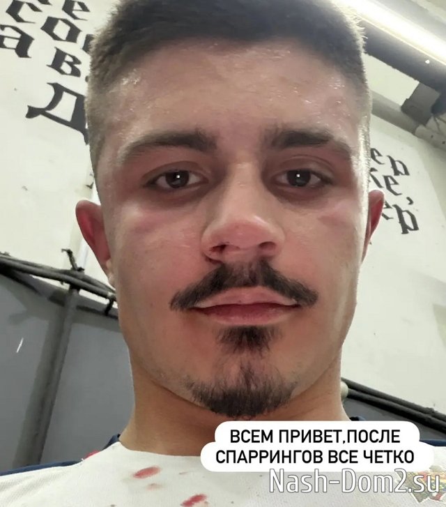 Никита Гуранда получил травму во время спарринга Никита Гуранда получил травму во время спарринга