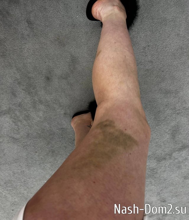 ������ �������: ��� ���� ��� ���� ����� �����
